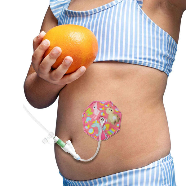 小児用 胃ろうパッド – かわいい柄でやさしい快適ケア | Kaio-Tube Pads