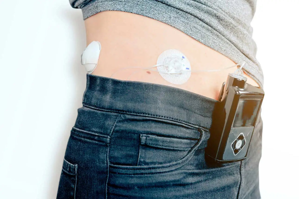 The Closed-Loop System for Diabetes Image