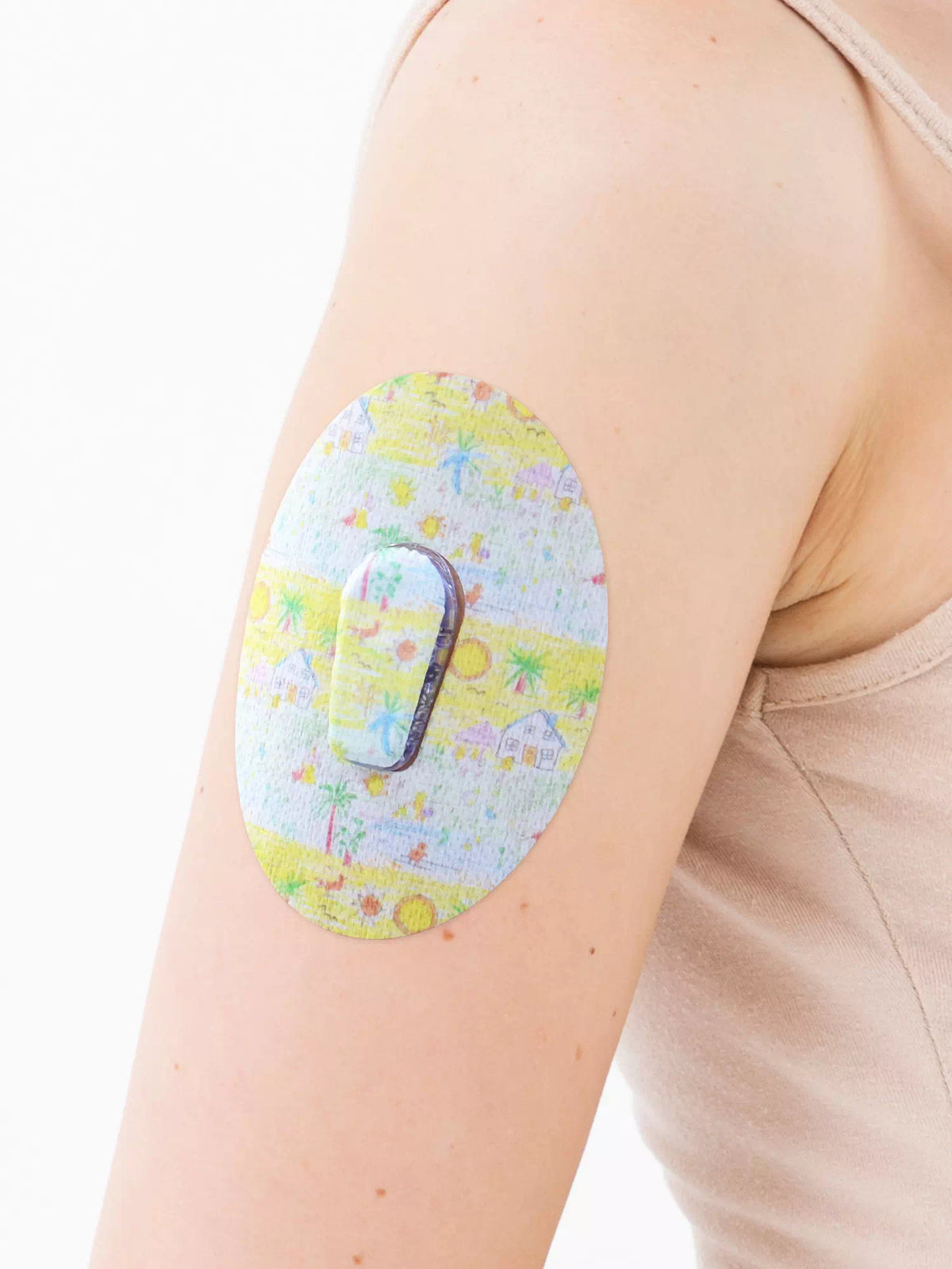 Dexcom G6用 固定パッチ、Childhood Memories 柄、腕に装着